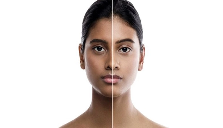 what-is-the-cost-of-skin-whitening-treatment-in-bangalore