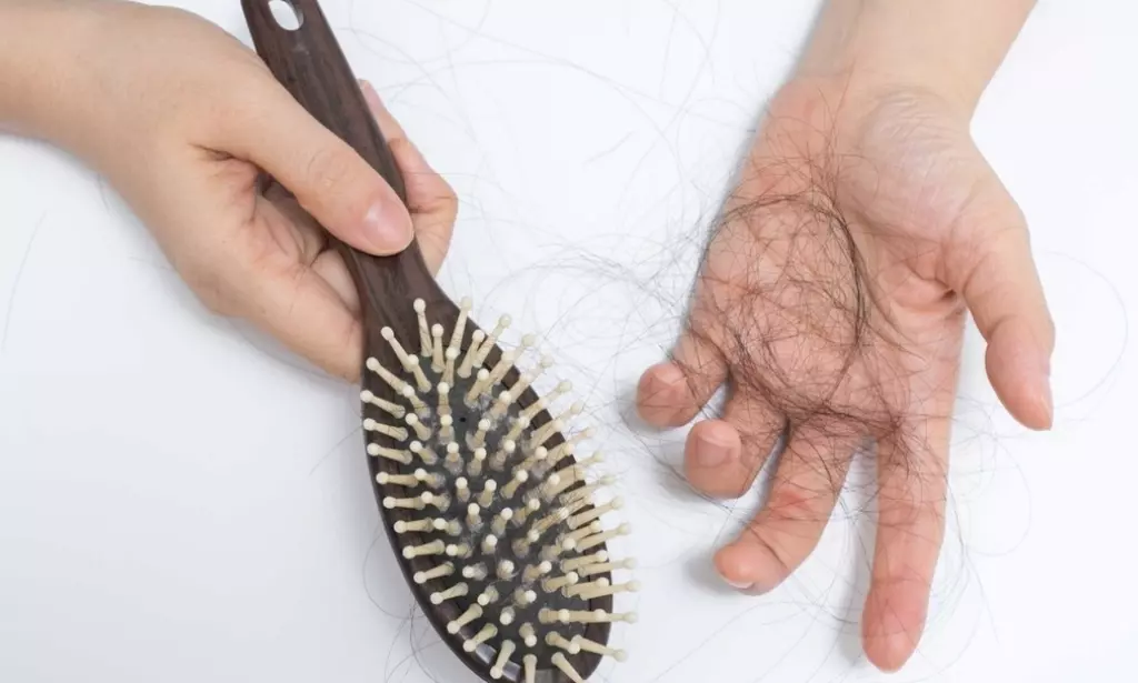 hairloss