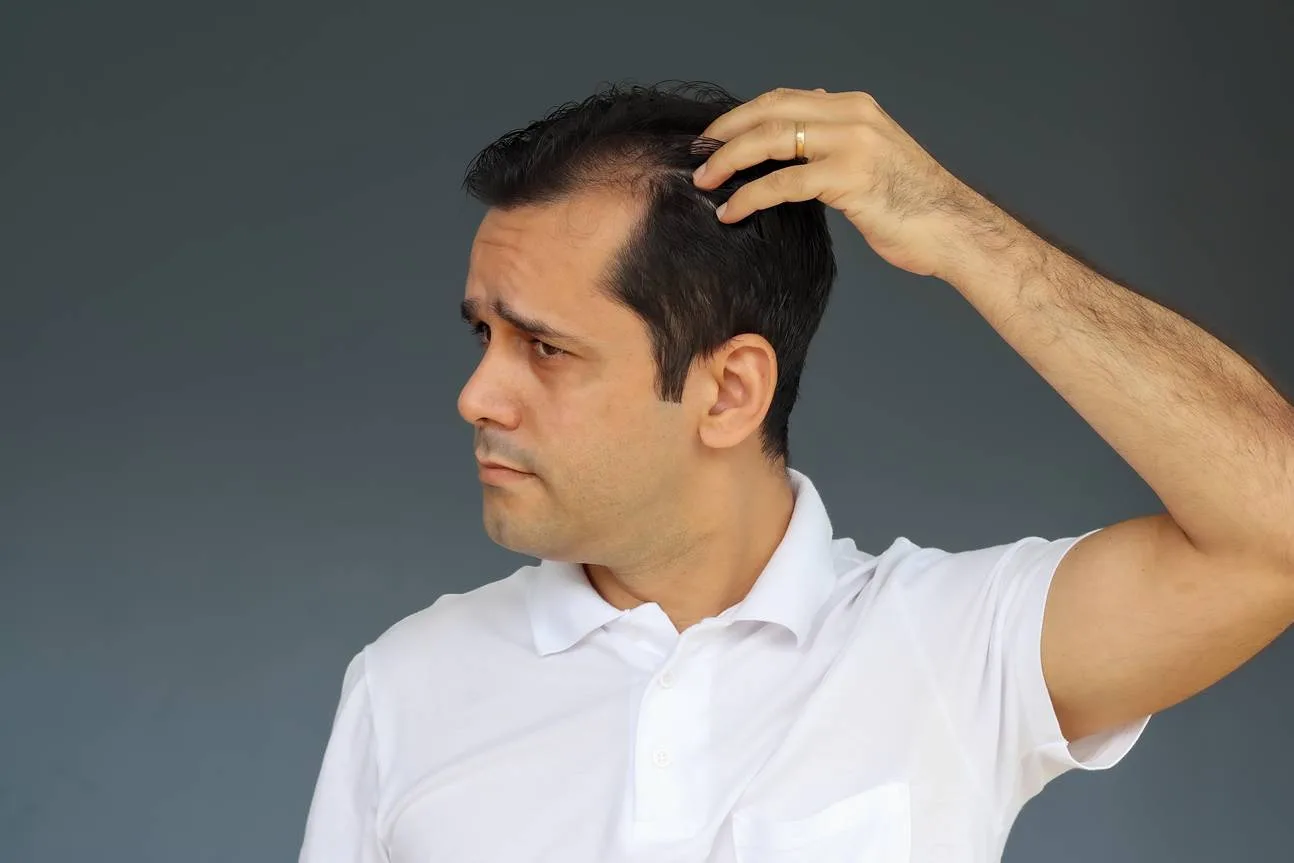 Scalp-Related Issues