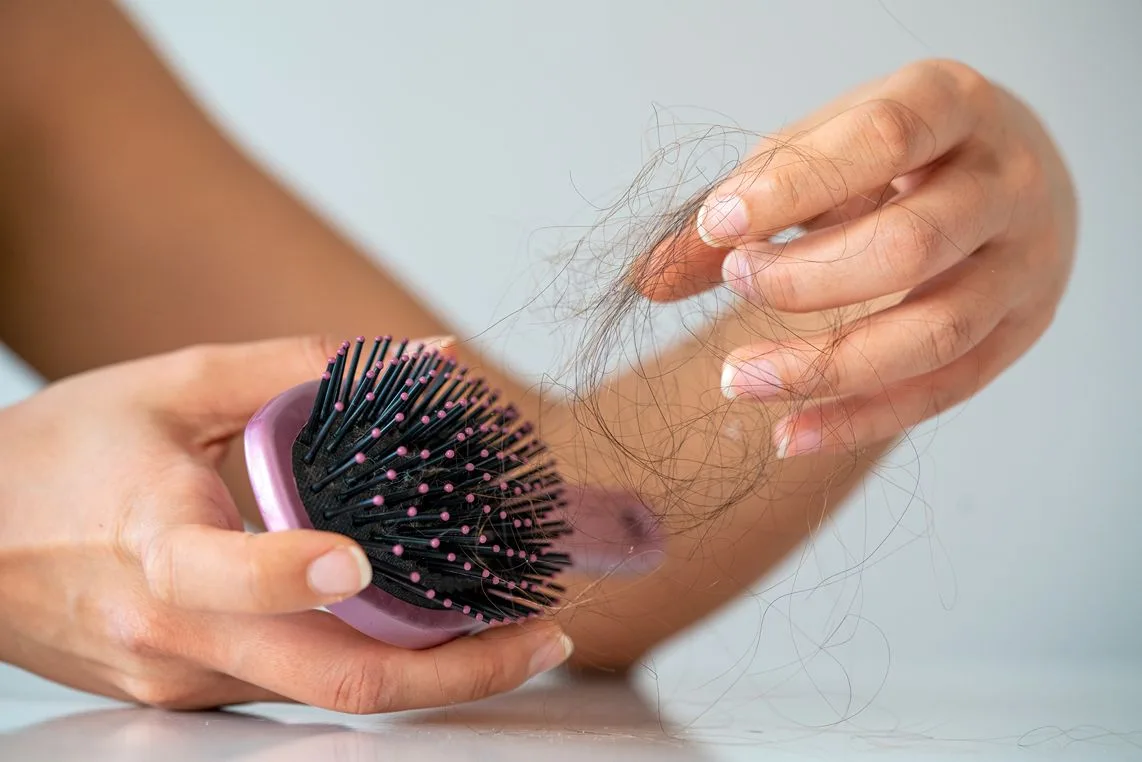 Female Pattern Hair-loss