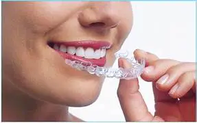 Braces & Aligners